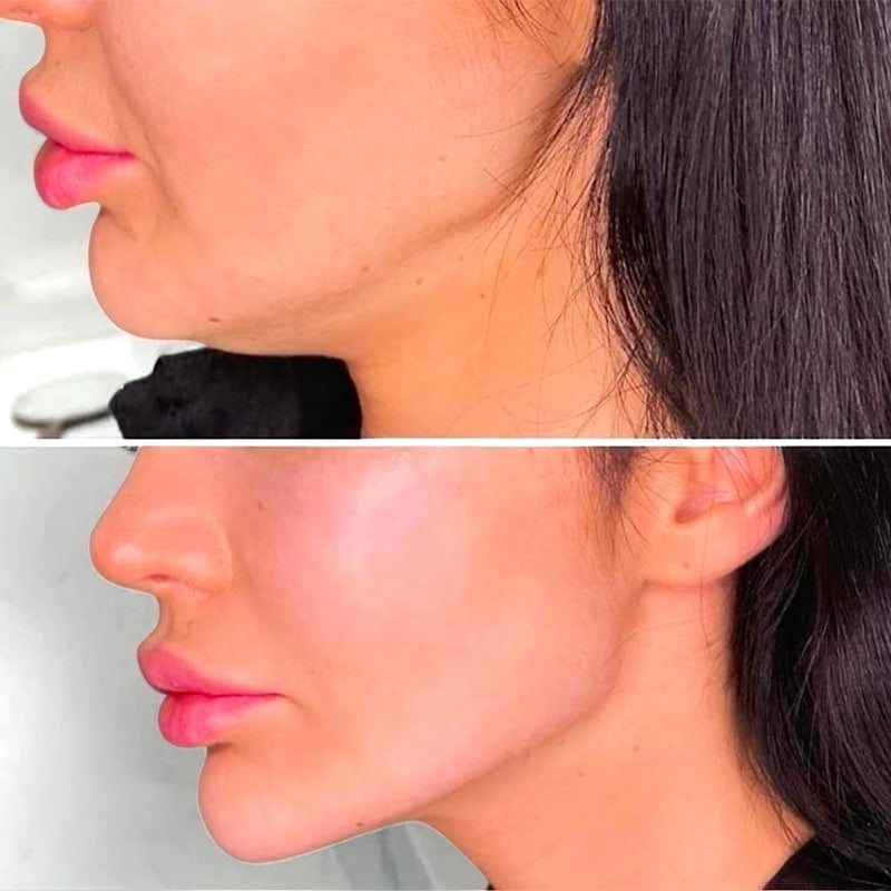 Feature product image